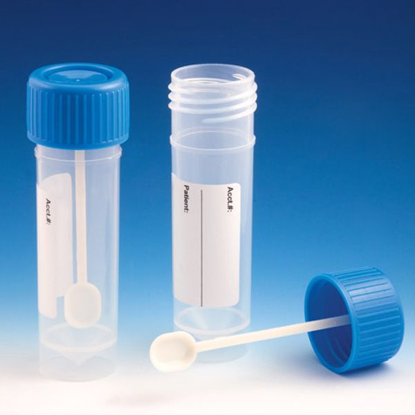 Globe Scientific 30mL Fecal/Stool Specimen Container&#44; Non-Sterile (Item 109120L)