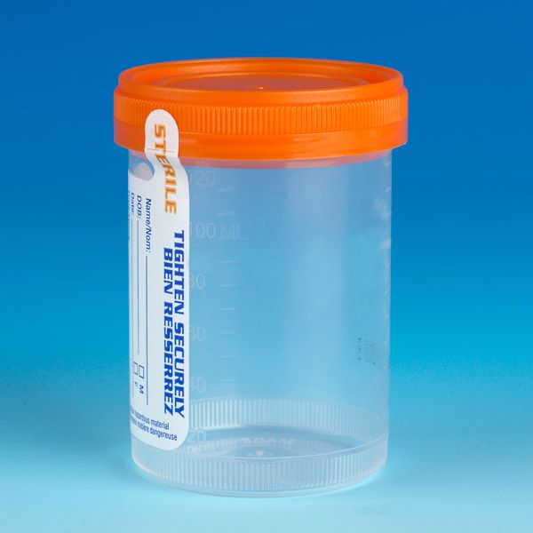 Globe Scientific 120mL Specimen Container&#44; Orange Cap