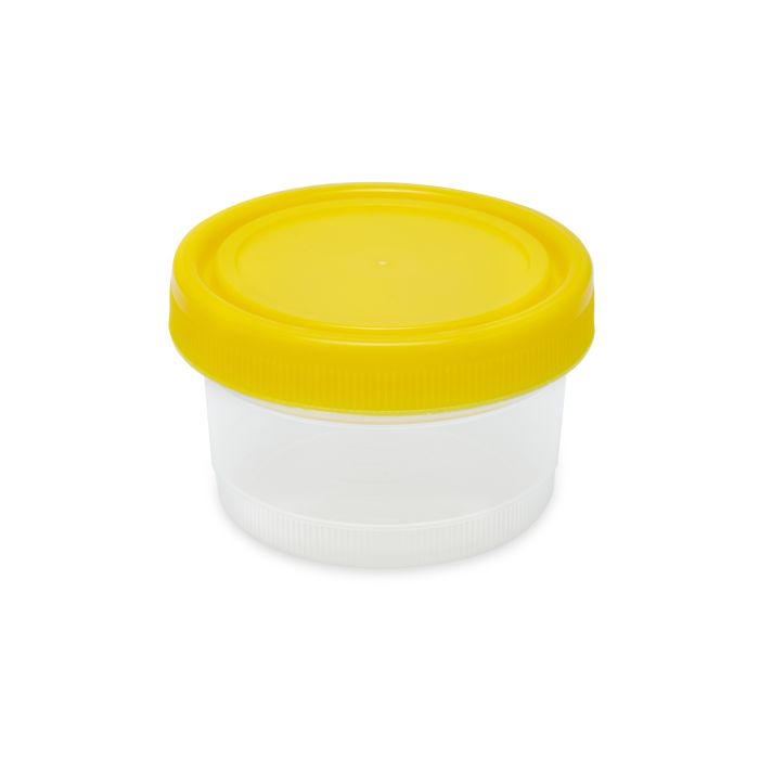 Globe Scientific 1000mL Histology Specimen Container&#44; Yellow Cap&#44; Non-Sterile