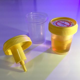 Globe Scientific 2oz Urine Collection Cup with Transfer Device, Sterile