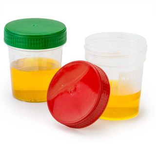 Globe Scientific 4oz Specimen Container, Green Cap, Non-Sterile, Frosted Writing Area